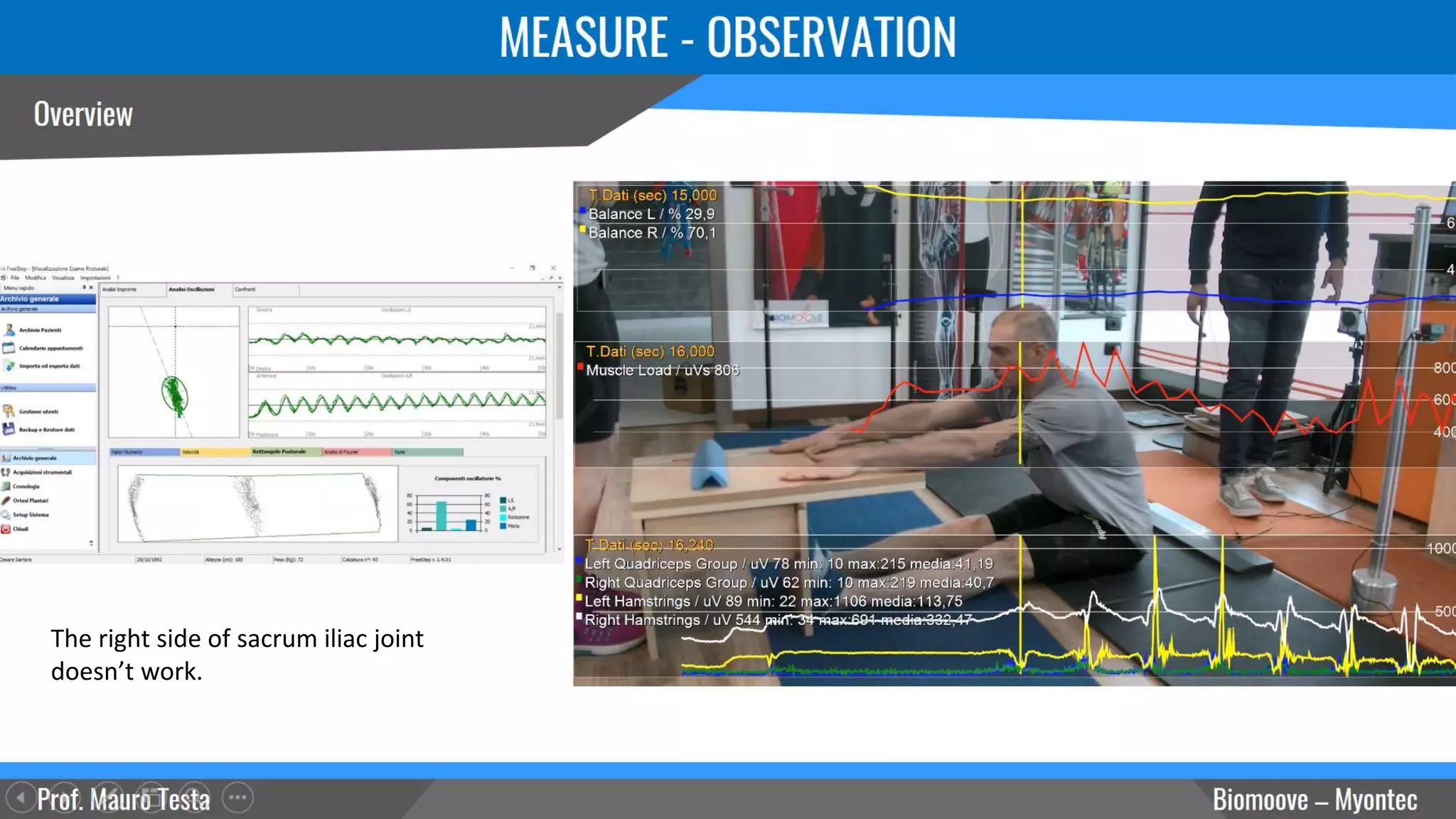 The right side of sacrum iliac joint
doesn’t work.
 