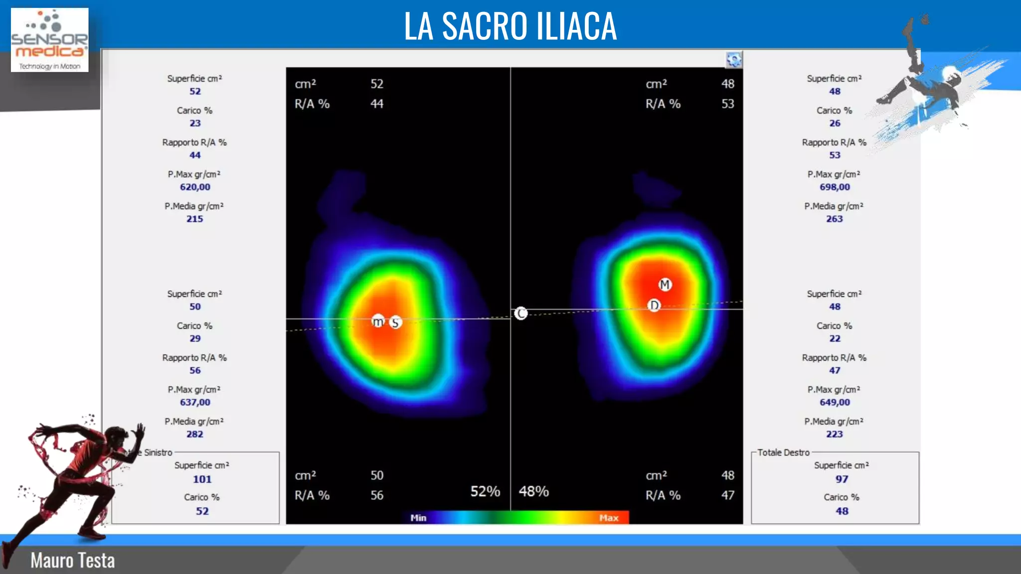 LA SACRO ILIACA
 