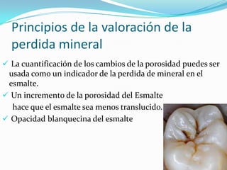 Principios de la valoración de la
perdida mineral
 La cuantificación de los cambios de la porosidad puedes ser

usada como un indicador de la perdida de mineral en el
esmalte.
 Un incremento de la porosidad del Esmalte
hace que el esmalte sea menos translucido.
 Opacidad blanquecina del esmalte

 