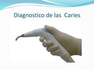 Diagnostico de las Caries

 
