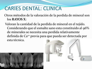 CARIES DENTAL: CLINICA
Otros métodos de la valoración de la perdida de mineral son
los RAYOS X:
Valoran la cantidad de la perdida de mineral en el tejido.
Considerando que el esmalte sano esta constituido al 96%
de minerales se necesita una perdida relativamente
definida de Ca2+ previa para que pueda ser detectada por
esta técnica.

 