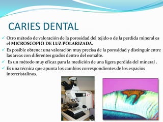 CARIES DENTAL
 Otro método de valoración de la porosidad del tejido o de la perdida mineral es

el MICROSCOPIO DE LUZ POLARIZADA.
 Es posible obtener una valoración muy precisa de la porosidad y distinguir entre
las áreas con diferentes grados dentro del esmalte.
 Es un método muy eficaz para la medición de una ligera perdida del mineral .
 Es una técnica que apunta los cambios correspondientes de los espacios
intercristalinos.

 