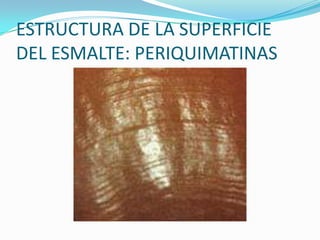 ESTRUCTURA DE LA SUPERFICIE
DEL ESMALTE: PERIQUIMATINAS

 