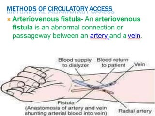 METHODS OF CIRCULATORYACCESS
 Arteriovenous fistula- An arteriovenous
fistula is an abnormal connection or
passageway between an artery and a vein.
 