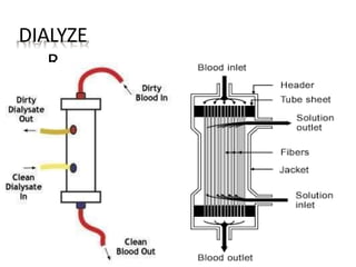DIALYZE
R
 