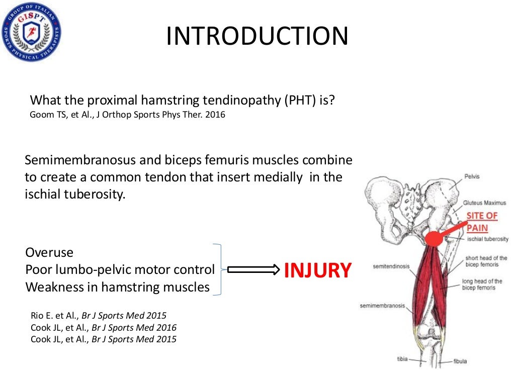 BILATERAL PROXIMAL HAMSTRING TENDINOPATHY IN ULTRAMARATHON RUNNER