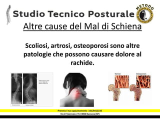 Via 27 Gennaio n°6 19038 Sarzana (SP)
Altre cause del Mal di Schiena
Scoliosi, artrosi, osteoporosi sono altre
patologie c...