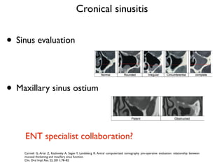 Sinus Lift and Immediate Implant Placement | PDF