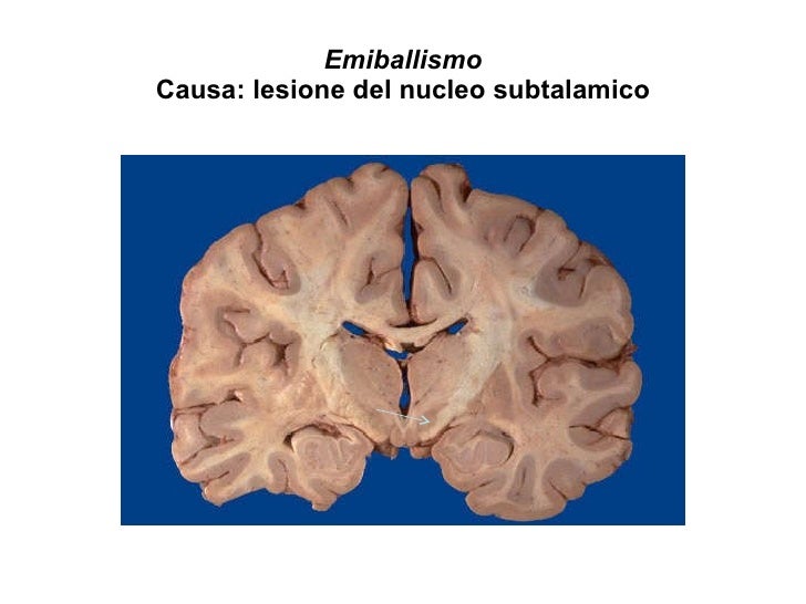 Presentazione Sancesario G.