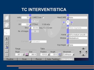 TC INTERVENTISTICA
 