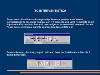 TC INTERVENTISTICA
Posso controllare finestra immagine (I pulsante) e posizione del tavolo ,
memorizzando la posizione migliore con il II pulsante, che verrà richiamata con il
III pulsante Funzioni con Pulsanti preconfigurati su tavolino di comando in sala.
Posso salvare immagini durante la procedura (pulsanti IV e V)
Posso misurare , distanze , angoli , attivare i laser per individuare sulla cute il
punto di ingresso
 