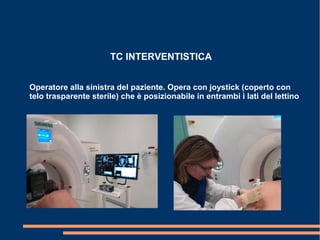 TC INTERVENTISTICA
Operatore alla sinistra del paziente. Opera con joystick (coperto con
telo trasparente sterile) che è posizionabile in entrambi i lati del lettino
 