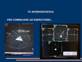 TC INTERVENTISTICA
PER COMINCIARE AD ESERCITARSI...
 