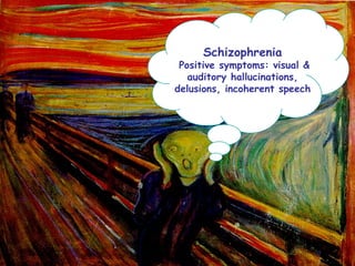 Schizophrenia Positive symptoms: visual & auditory hallucinations, delusions, incoherent speech 