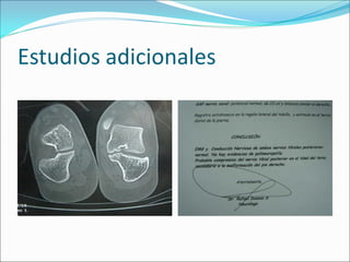 Estudios adicionales
 