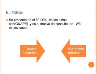 EL EDEMA
   Se presenta en el 80-90% de los niños
    con(GNAPE) y es el motivo de consulta de 2/3
    de los casos.




             Edema                      Miembros
            parpebral                   inferiores
 