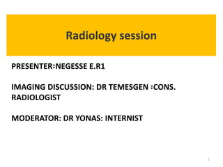 PRESENTER፡NEGESSE E.R1
IMAGING DISCUSSION: DR TEMESGEN ፡CONS.
RADIOLOGIST
MODERATOR: DR YONAS: INTERNIST
Radiology session
1
 