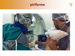 piriforme
 