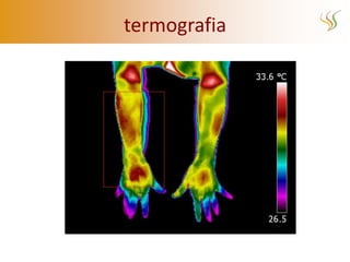 termografia
 