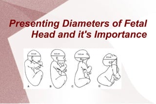 Presenting Diameters of Fetal
Head and it's Importance
 