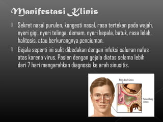  Sekret nasal purulen, kongesti nasal, rasa tertekan pada wajah,
  nyeri gigi, nyeri telinga, demam, nyeri kepala, batuk, rasa lelah,
  halitosis, atau berkurangnya penciuman.
 Gejala seperti ini sulit dibedakan dengan infeksi saluran nafas
  atas karena virus. Pasien dengan gejala diatas selama lebih
  dari 7 hari mengarahkan diagnosis ke arah sinusitis.
 