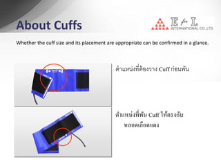 การพัน cuff pressure ในลักษณะต่ างๆ
 Blue-colored area: transmitted cuff pressure through tissue




    A. Cuff ที่เหมาะส...