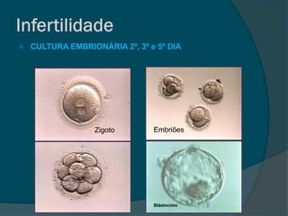    CULTURA EMBRIONÁRIA 2º, 3º e 5º DIA




                  Zigoto        Embriões




                                Blástocisto
 