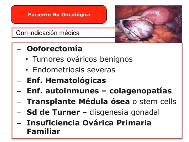 Prednisolone 25mg Online