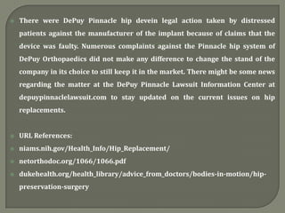  There were DePuy Pinnacle hip devein legal action taken by distressed
patients against the manufacturer of the implant because of claims that the
device was faulty. Numerous complaints against the Pinnacle hip system of
DePuy Orthopaedics did not make any difference to change the stand of the
company in its choice to still keep it in the market. There might be some news
regarding the matter at the DePuy Pinnacle Lawsuit Information Center at
depuypinnaclelawsuit.com to stay updated on the current issues on hip
replacements.
 URL References:
 niams.nih.gov/Health_Info/Hip_Replacement/
 netorthodoc.org/1066/1066.pdf
 dukehealth.org/health_library/advice_from_doctors/bodies-in-motion/hip-
preservation-surgery
 