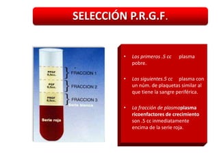 SELECCIÓN P.R.G.F.


         •   Los primeros .5 cc   plasma
             pobre.

         •   Los siguientes.5 cc plasma con
             un núm. de plaquetas similar al
             que tiene la sangre periférica.

         •   La fracción de plasmaplasma
             ricoenfactores de crecimiento
             son .5 cc inmediatamente
             encima de la serie roja.
 