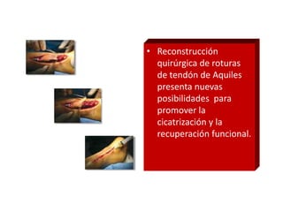• Reconstrucción
  quirúrgica de roturas
  de tendón de Aquiles
  presenta nuevas
  posibilidades para
  promover la
  cicatrización y la
  recuperación funcional.
 