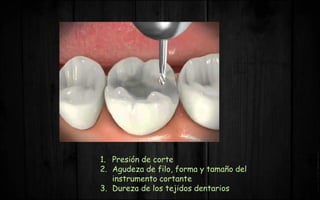 1. Presión de corte
2. Agudeza de filo, forma y tamaño del
instrumento cortante
3. Dureza de los tejidos dentarios
 