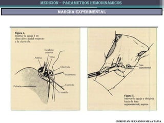 MEDICIÓN – PARAMETROS HEMODINÁMICOS

       Marcha experimental




                                CHRISTIAN FERNANDO SILVA TAPIA
 
