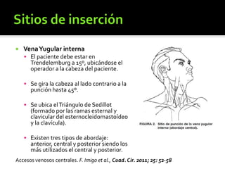  VenaYugular interna
 El paciente debe estar en
Trendelemburg a 15º, ubicándose el
operador a la cabeza del paciente.
 Se gira la cabeza al lado contrario a la
punción hasta 45º.
 Se ubica elTriángulo de Sedillot
(formado por las ramas esternal y
clavicular del esternocleidomastoídeo
y la clavícula).
 Existen tres tipos de abordaje:
anterior, central y posterior siendo los
más utilizados el central y posterior.
Accesos venosos centrales. F. Imigo et al., Cuad. Cir. 2011; 25: 52-58
 