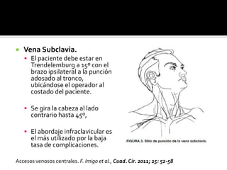  Vena Subclavia.
 El paciente debe estar en
Trendelemburg a 15º con el
brazo ipsilateral a la punción
adosado al tronco,
ubicándose el operador al
costado del paciente.
 Se gira la cabeza al lado
contrario hasta 45º,
 El abordaje infraclavicular es
el más utilizado por la baja
tasa de complicaciones.
Accesos venosos centrales. F. Imigo et al., Cuad. Cir. 2011; 25: 52-58
 