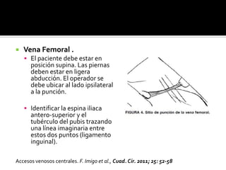  Vena Femoral .
 El paciente debe estar en
posición supina. Las piernas
deben estar en ligera
abducción. El operador se
debe ubicar al lado ipsilateral
a la punción.
 Identificar la espina iliaca
antero-superior y el
tubérculo del pubis trazando
una línea imaginaria entre
estos dos puntos (ligamento
inguinal).
Accesos venosos centrales. F. Imigo et al., Cuad. Cir. 2011; 25: 52-58
 