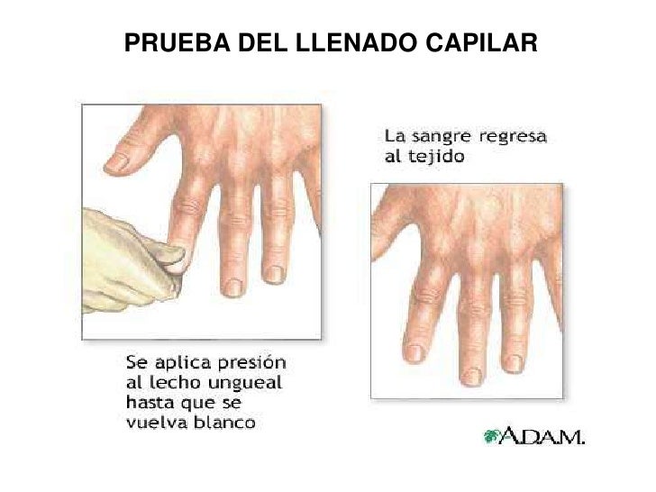 Presion arterial