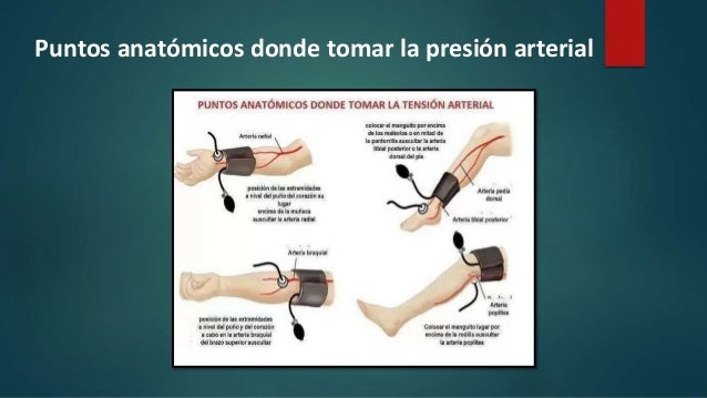 Puntos Anatomicos Para Tomar La Presion Arterial es.slideshare.net