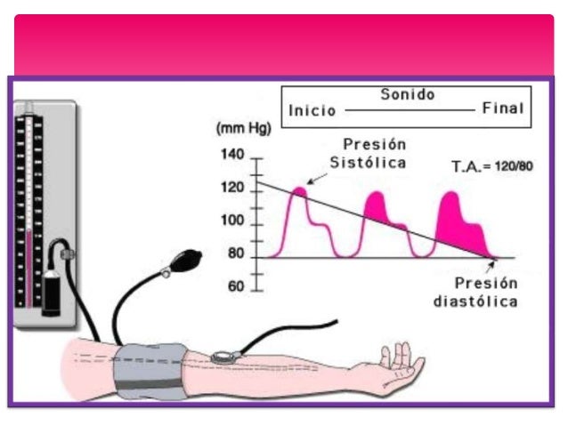 Presion arterial j@azz