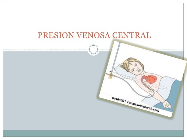 Presion venosa central