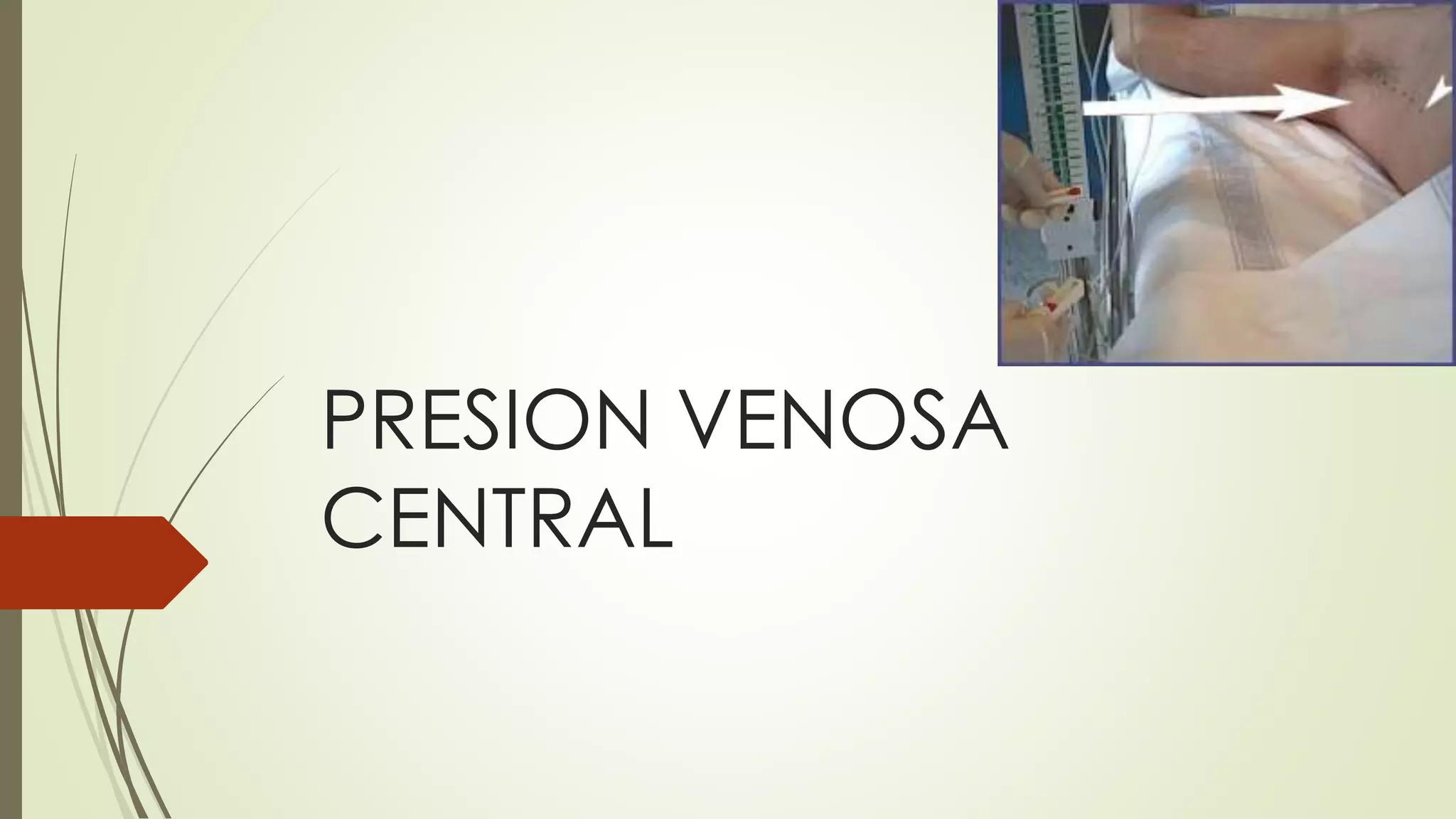 Presion venosa central | PPTX | First Aid | Injuries