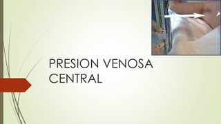 PRESION VENOSA
CENTRAL
 
