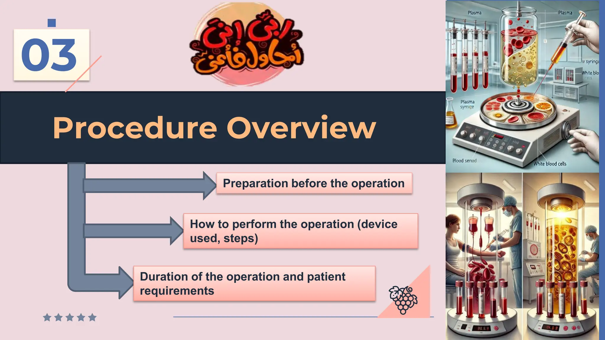 Procedure Overview
03
Preparation before the operation
How to perform the operation (device
used, steps)
Duration of the operation and patient
requirements
 