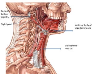 Anterior belly of
digastric muscle
Posterior
belly of
digastric
Stylohyoid
Sternohyoid
muscle
 