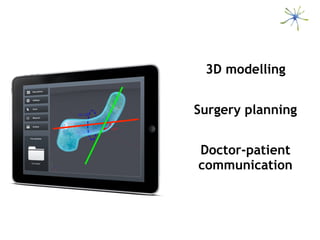 3D modelling


Surgery planning


Doctor-patient
communication
 