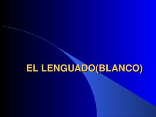 EL LENGUADO
EL LENGUADO(BLANCO)
(BLANCO)
 