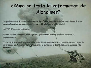 ¿Cuáles son los síntomas de la enfermedad de Alzheimer? 