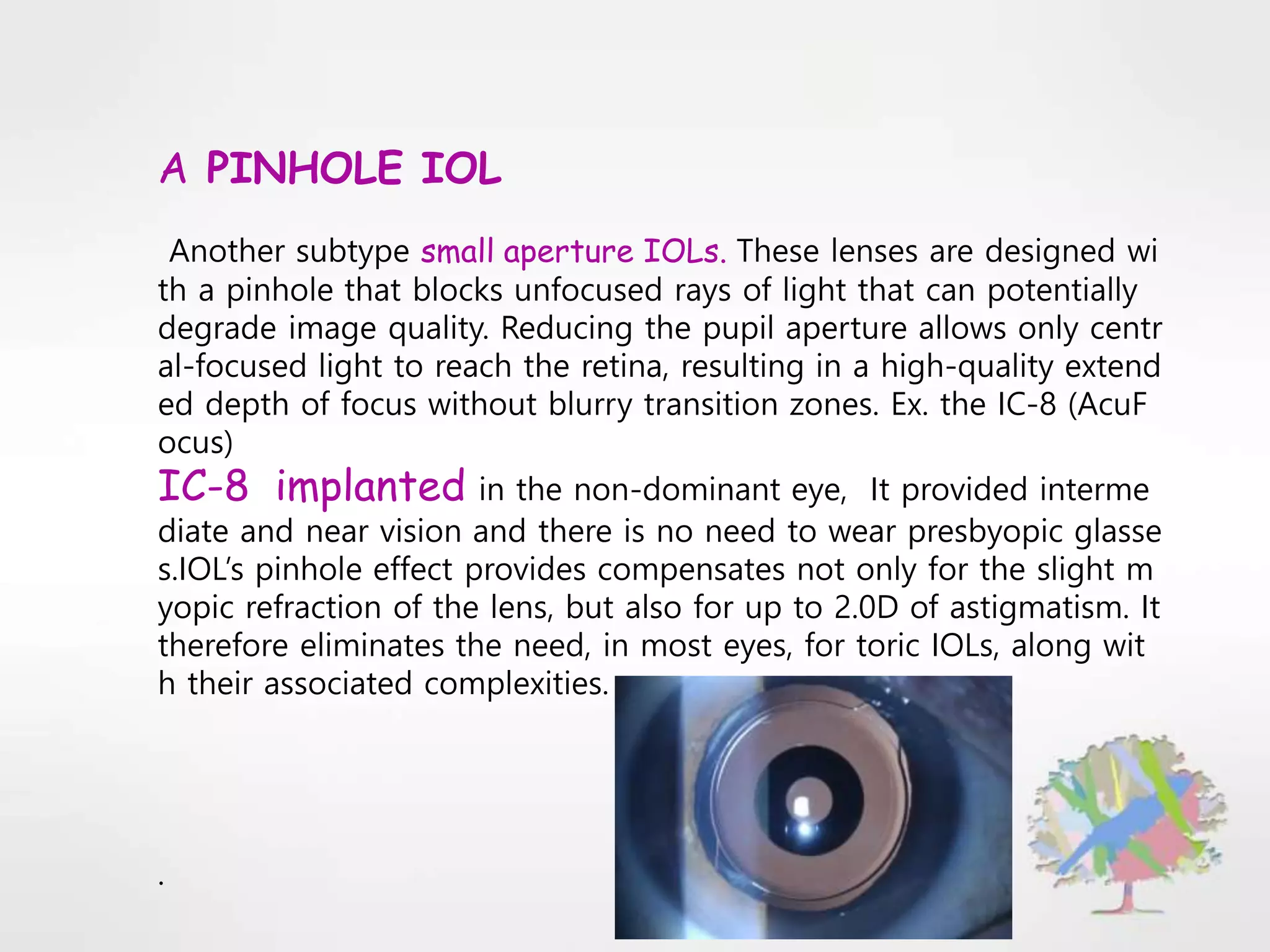 A PINHOLE IOL
Another subtype small aperture IOLs. These lenses are designed wi
th a pinhole that blocks unfocused rays of light that can potentially
degrade image quality. Reducing the pupil aperture allows only centr
al-focused light to reach the retina, resulting in a high-quality extend
ed depth of focus without blurry transition zones. Ex. the IC-8 (AcuF
ocus)
IC-8 implanted in the non-dominant eye, It provided interme
diate and near vision and there is no need to wear presbyopic glasse
s.IOL’s pinhole effect provides compensates not only for the slight m
yopic refraction of the lens, but also for up to 2.0D of astigmatism. It
therefore eliminates the need, in most eyes, for toric IOLs, along wit
h their associated complexities.
.
 
