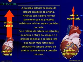 Copyright © RHVIDA S/C Ltda. www.rhvida.com.br
A pressão arterial depende da
largura (calibre) da artéria.
Artérias com calibre normal
permitem que as pressões
máxima e mínima sejam também
normais.
Se o calibre da artéria se estreitar,
aumenta o atrito do sangue e a
pressão mínima; o coração terá
que fazer mais força para
empurrar o sangue dentro da
artéria, aumentando a pressão
máxima.
pressão
normal
artéria
normal
pressão
aumentada
artéria
estreitada
 