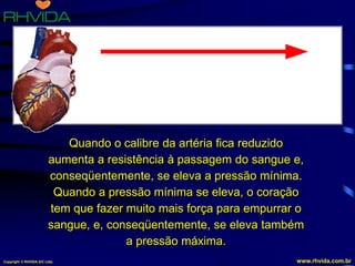 Copyright © RHVIDA S/C Ltda. www.rhvida.com.br
Quando o calibre da artéria fica reduzido
aumenta a resistência à passagem do sangue e,
conseqüentemente, se eleva a pressão mínima.
Quando a pressão mínima se eleva, o coração
tem que fazer muito mais força para empurrar o
sangue, e, conseqüentemente, se eleva também
a pressão máxima.
Artéria com calibre reduzido.
O sangue passa com dificuldade.
Pressão arterial alterada, tipo 18 x 10.
 